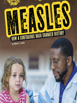 cover image of Measles